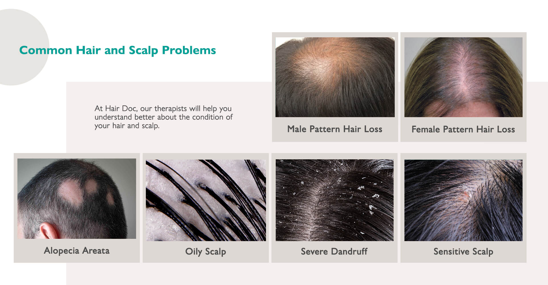 Common Hair and Scalp Problems | Examples & Solutions | Hair Doc